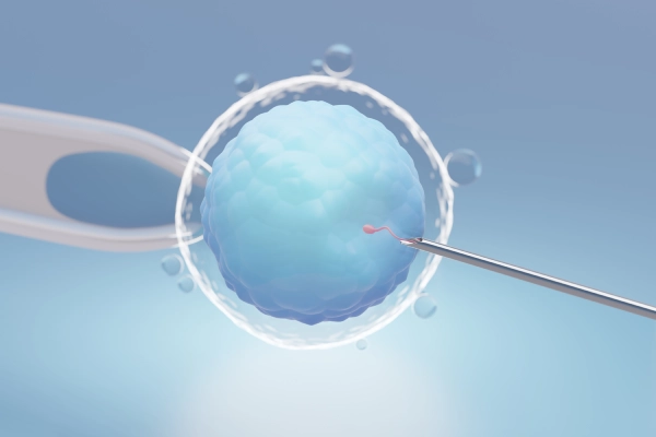 IVF Consultation IVF Consultation